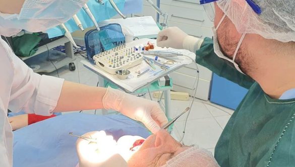 Kirurgji dentare