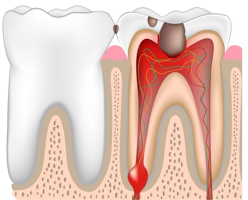 danger-of-infected-tooth