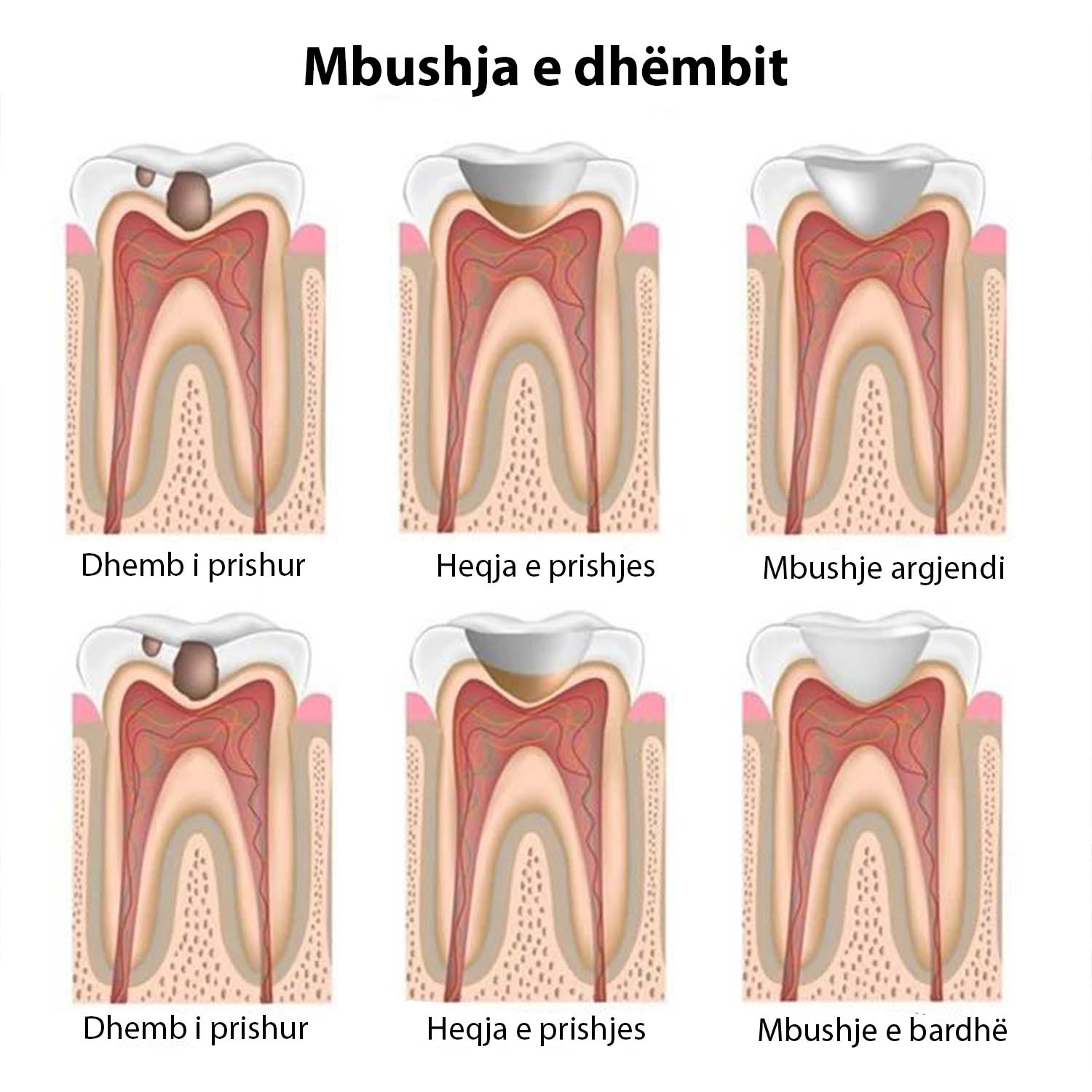 mbushje