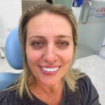 A difficult case with 9 implants and zirconia crowns on top of the implants