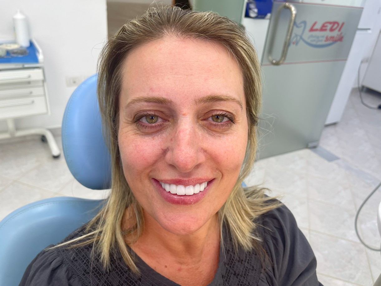 A difficult case with 9 implants and zirconia crowns on top of the implants